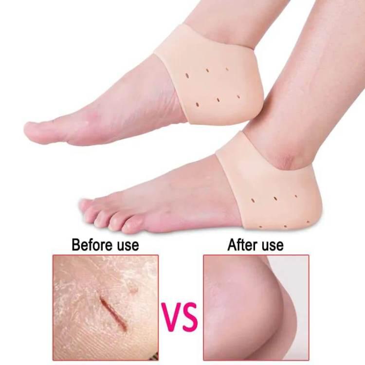 Silicone Heel Anti-Crack Sets Heel Support (Free Size, Beige)